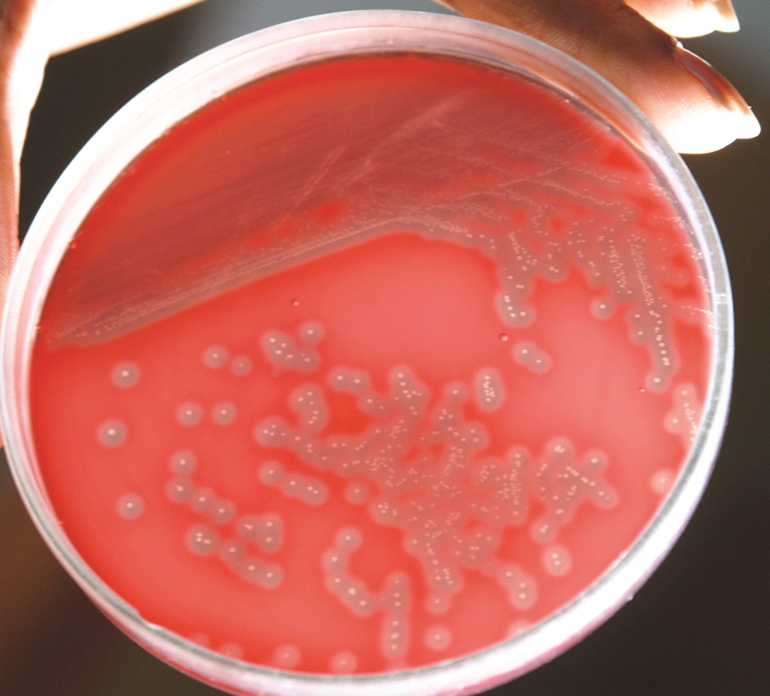 Azide Blood Agar Base (M158) - Streptococci