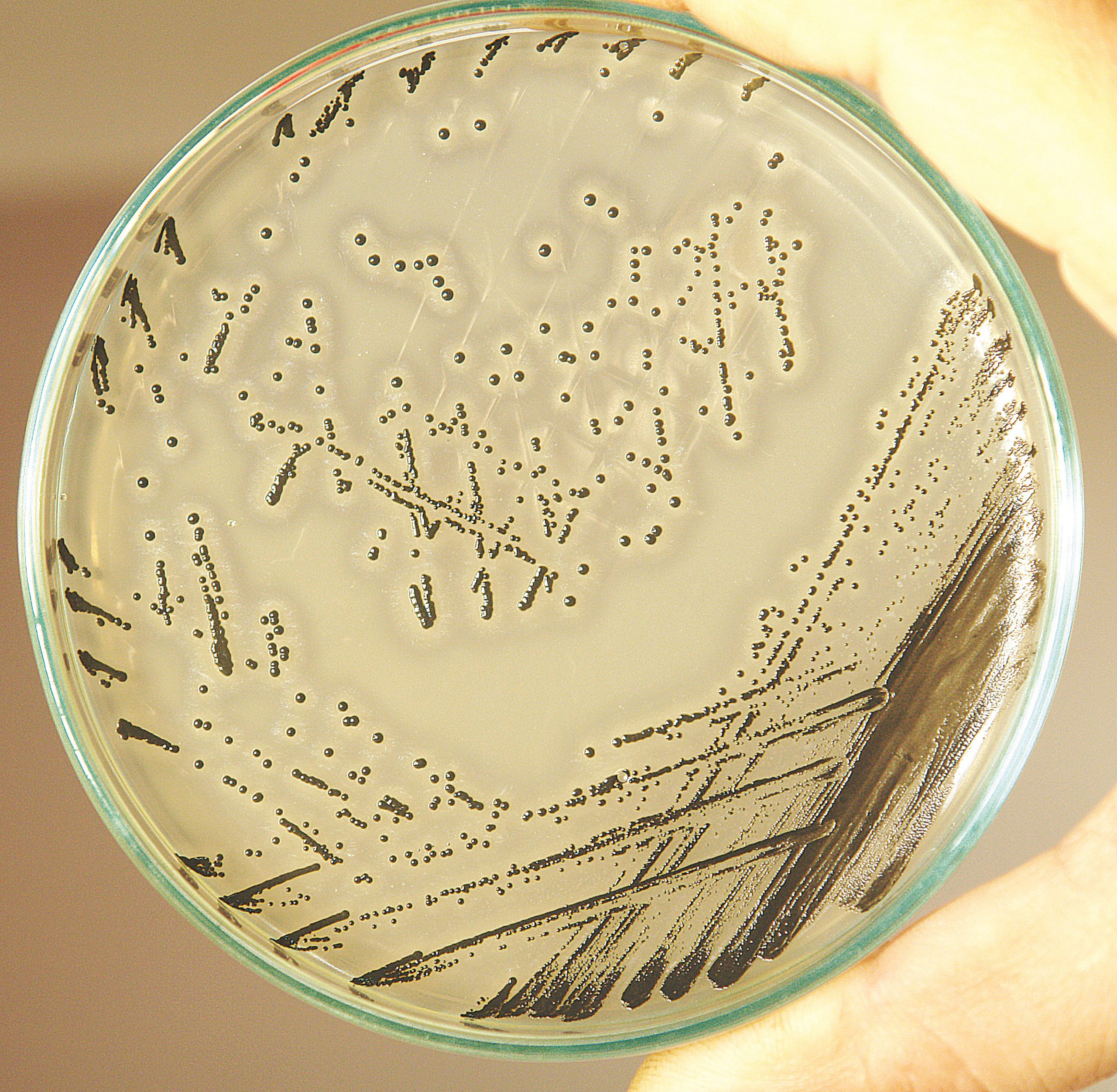 Baird Parker Agar Base (M043) and Egg Yolk Emulsion (FD045)