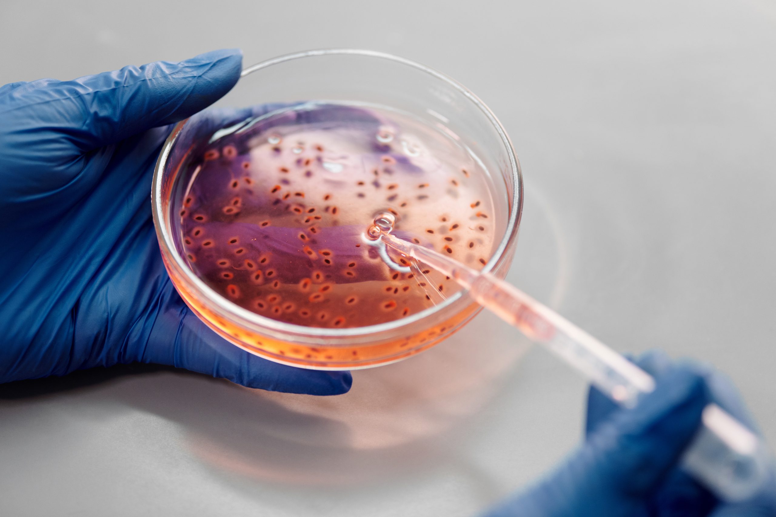 Molecular Biology - Petri dish with bacteria and pipette