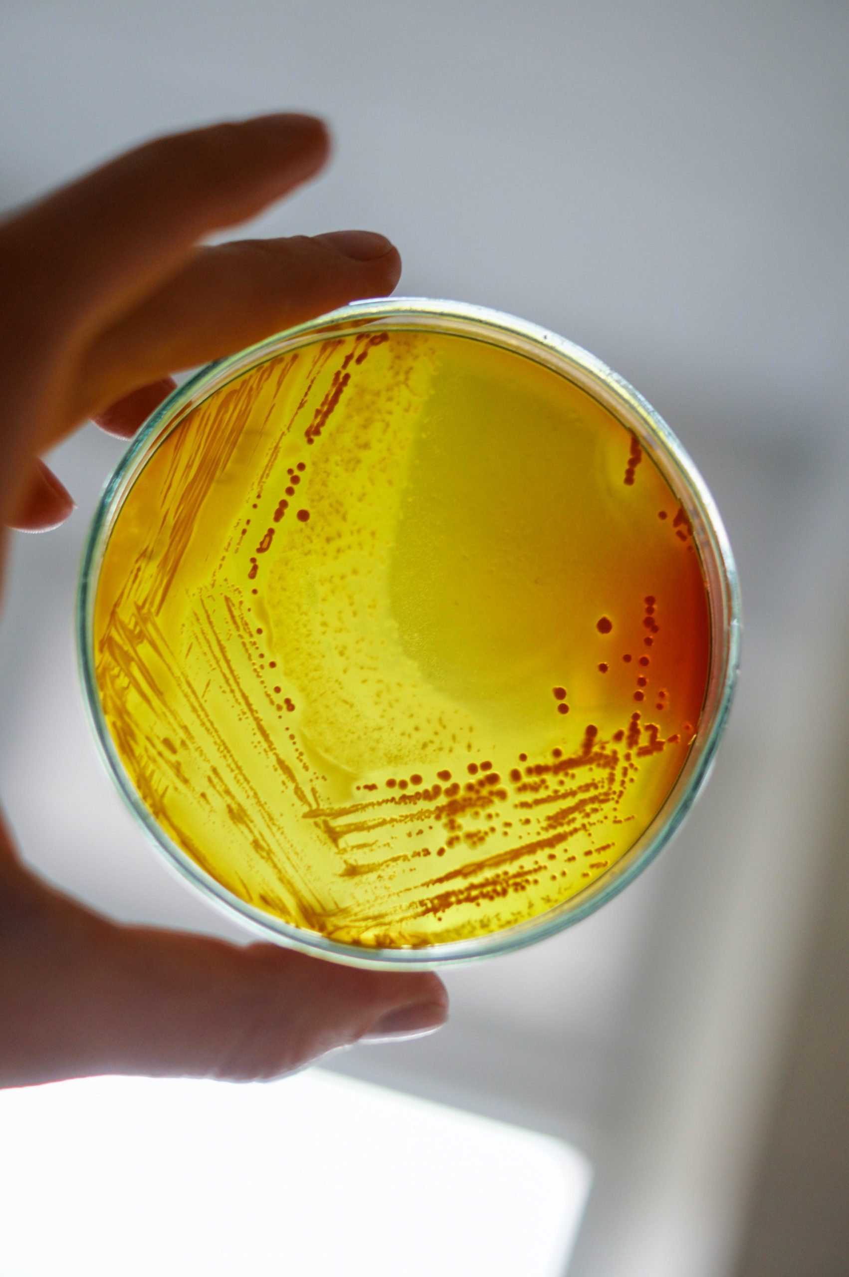 Petri dish with smeared bacteria