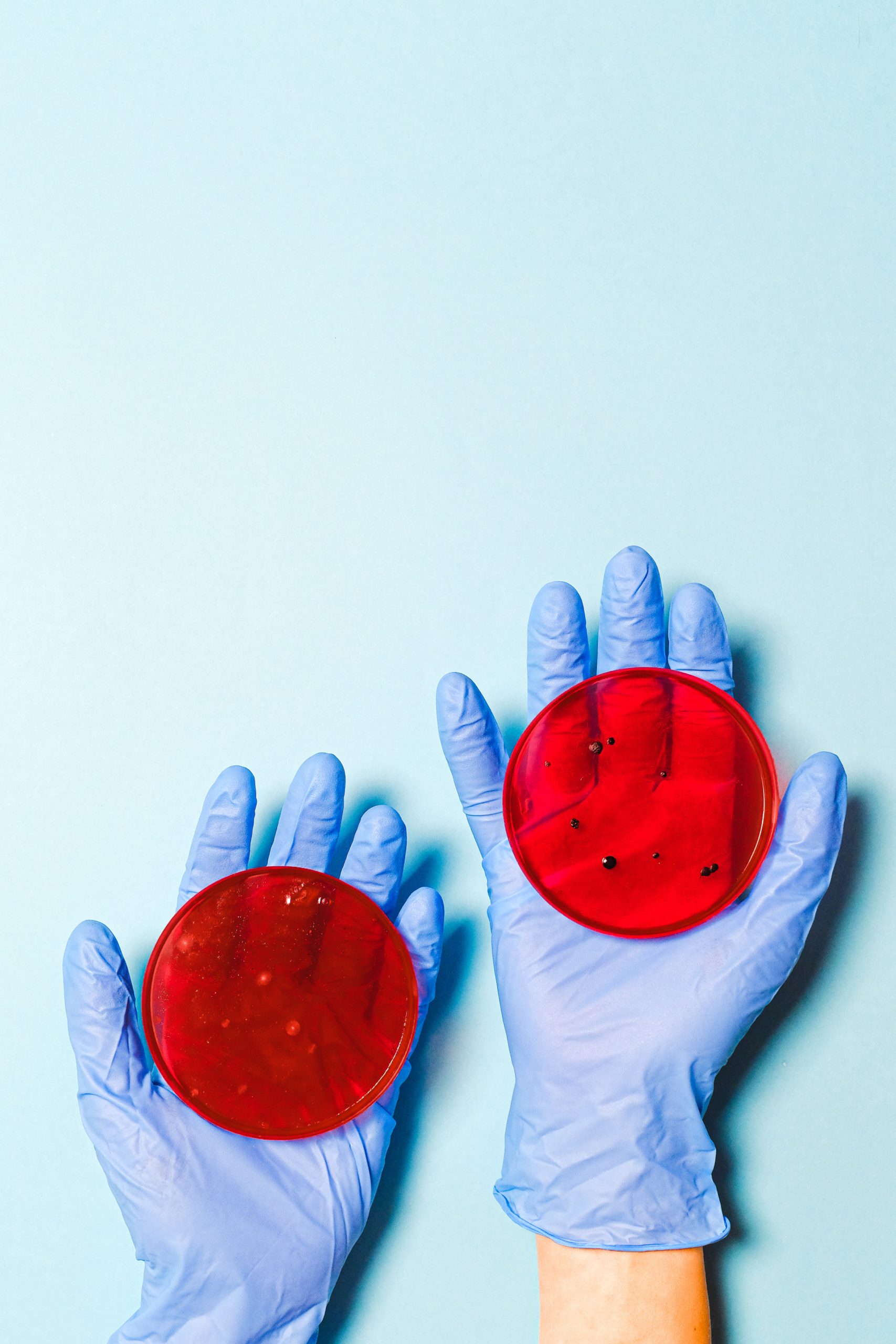 red petri dishes in two hands