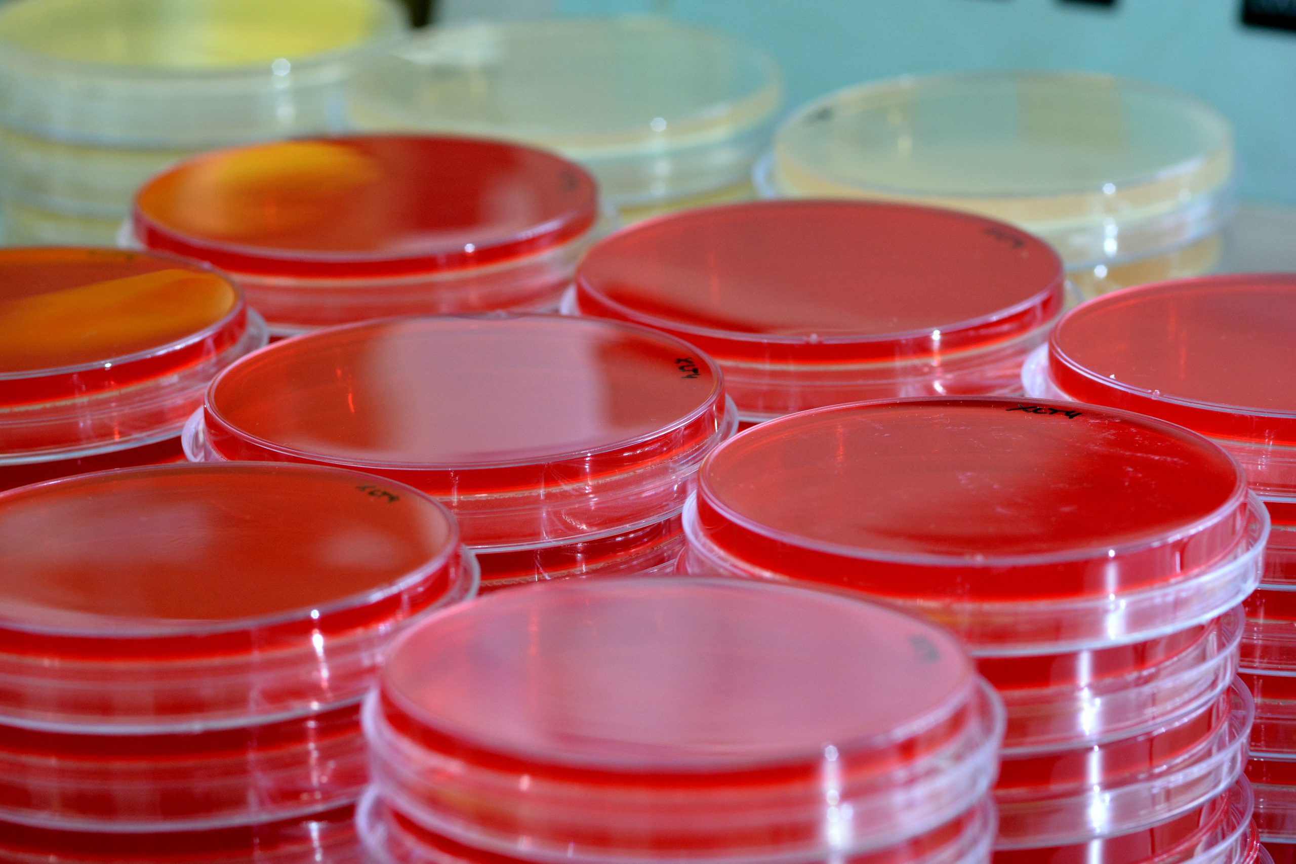 red petri dishes