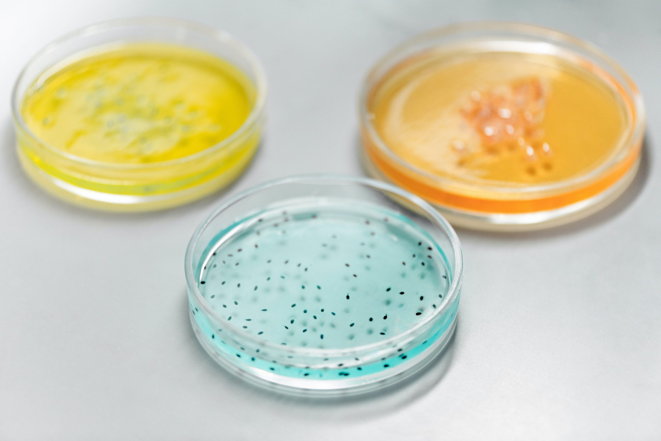 Three petri dishes