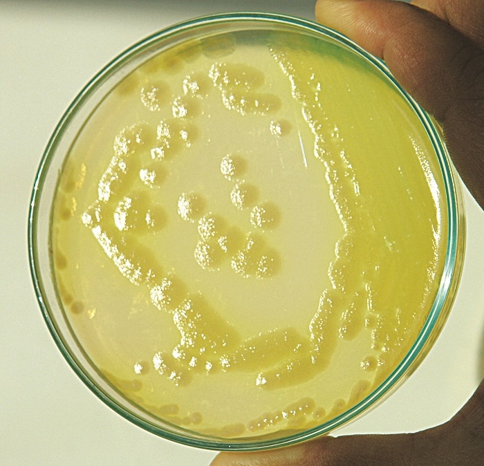 Cetrimide Agar Base (M024) for the selective isolation of Pseudomonas aeruginosa