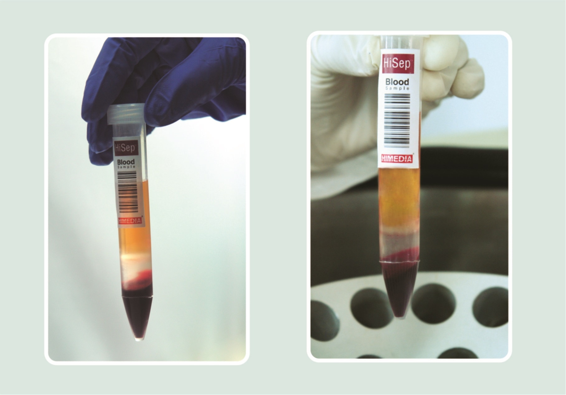 Density Gradient Separation Media HiSep