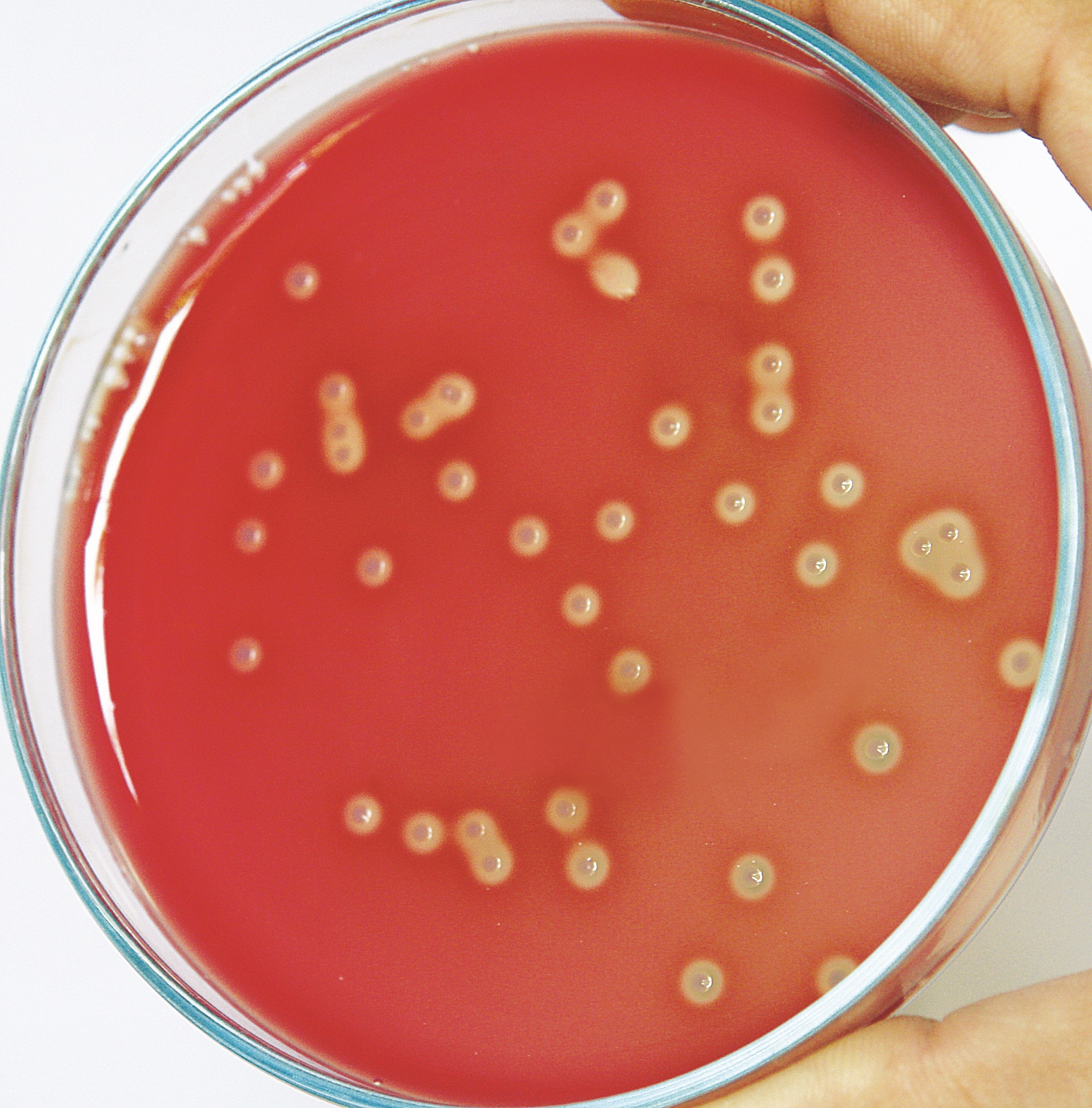 Edwards Medium Base, Modified (M748) - Streptococcus agalactiae