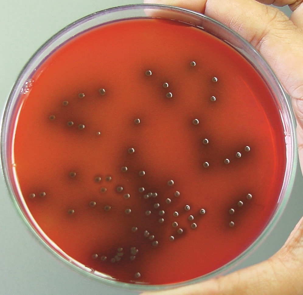 Listeria Identification Agar Base (PALCAM) (M1064)